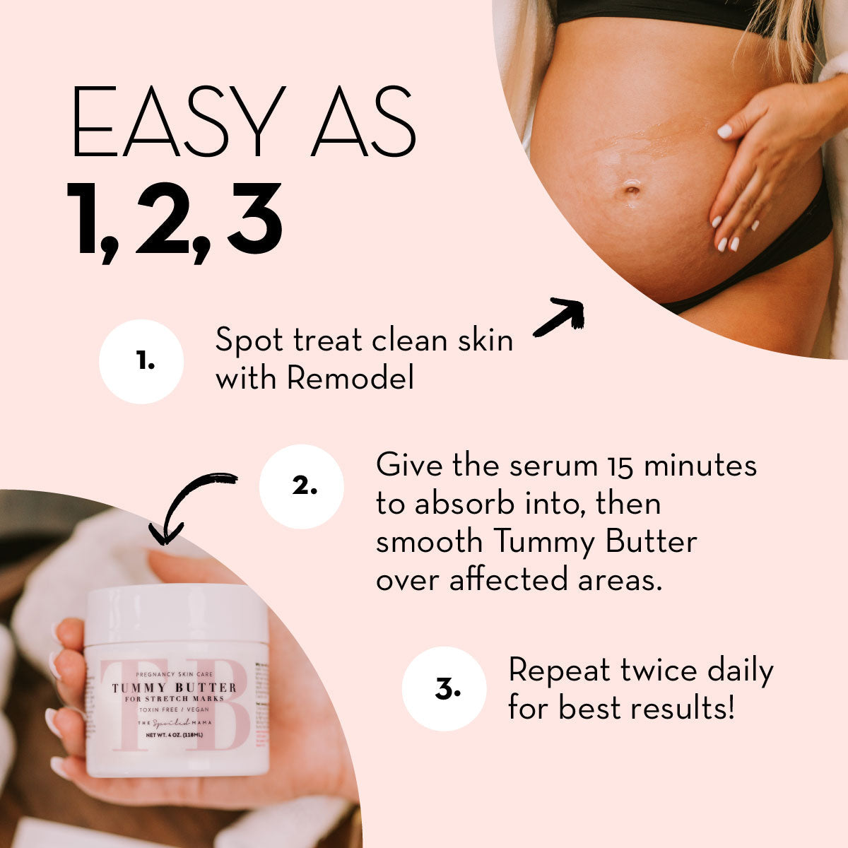ReModel Serum: Stretch Mark Treatment - HoneyBug