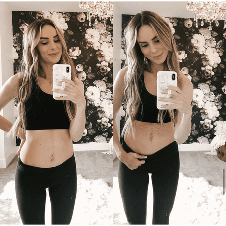 Tummy Butter Postpartum Stretch Mark Cream - HoneyBug 